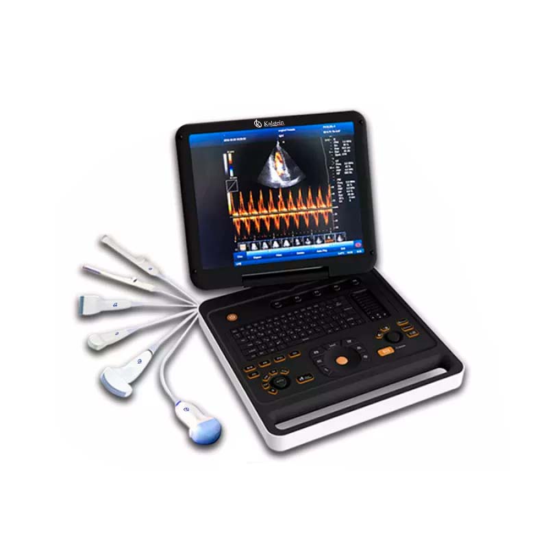 Advancing Medicine with the Kalstein Ultrasound Scanner